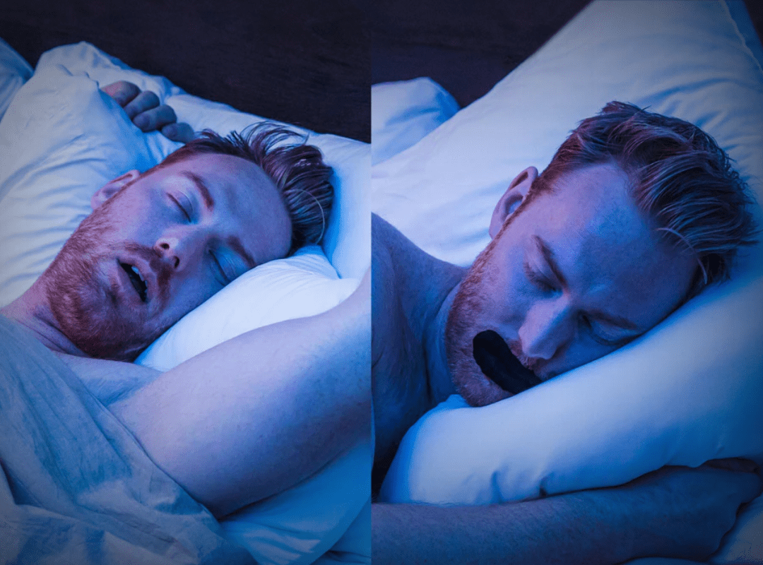 Cinta bucal para dormir: el protocolo seguro para respirar por la nariz de noche