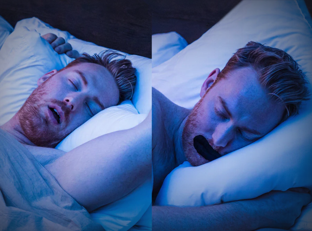 Cinta bucal para dormir: el protocolo seguro para respirar por la nariz de noche